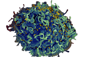 HIV Tcell