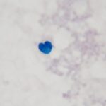 Heart Shaped Macrophage